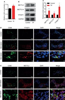 YTHDF1 Negatively Regulates Treponema pallidum-Induced Inflammation in THP-1 Macrophages by Promoting SOCS3 Translation in an m6A-Dependent Manner